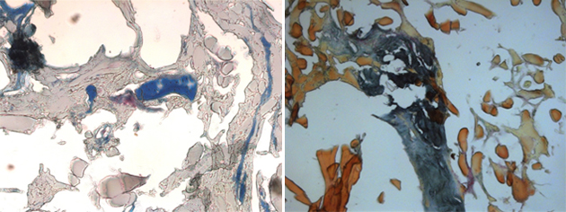 Abb. 2 a-f: Histologische Präparate.