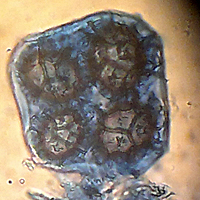 Abbildung: "Ascus mit 4 Sporen von T. aestivum, 400 x, angefärbt mit Baumwollblau".